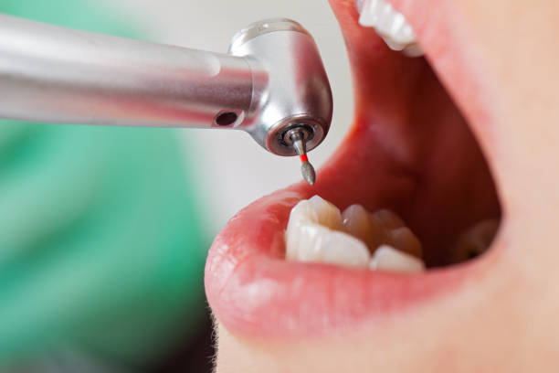 Best Emergency Dental Care for Sports Injuries in Cape St Claire, MD